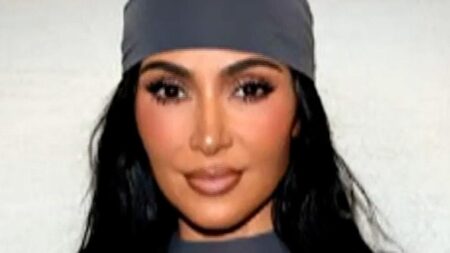 Kim Kardashian Reveals Brain Aneurysm Diagnosis: Key Warning Signs You Should Know – news-usa.info